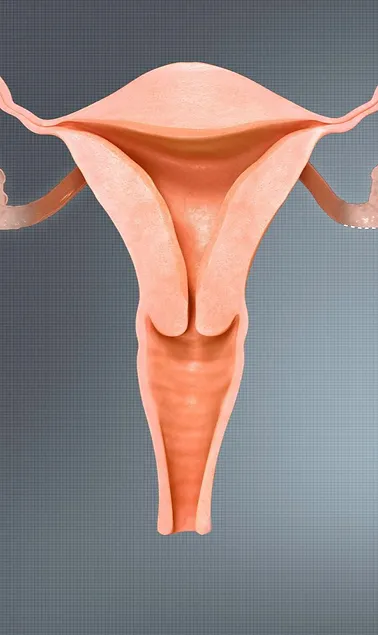 Read more about the article PCOS – alternative diet